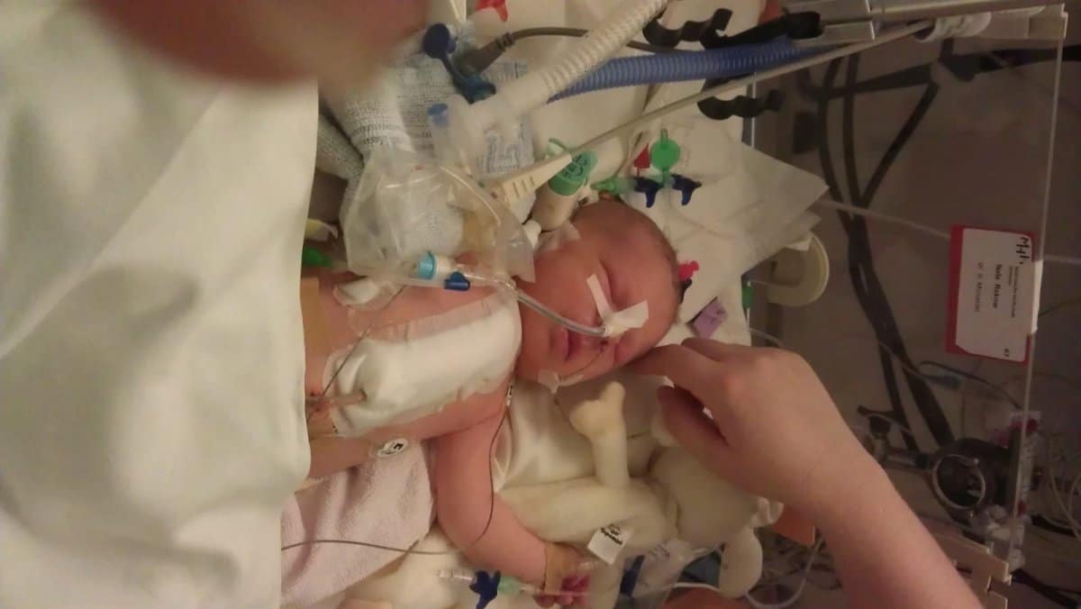 Operationen statt Kuscheln – unsere Tochter kam schwerkrank zur Welt