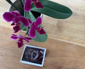 Stadt Land Schwanger: Heute gibt’s wunderschöne Baby-News ❤️