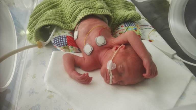 Weltfrühgeborenentag: „Frühchen Emma kämpft sich ins Leben“