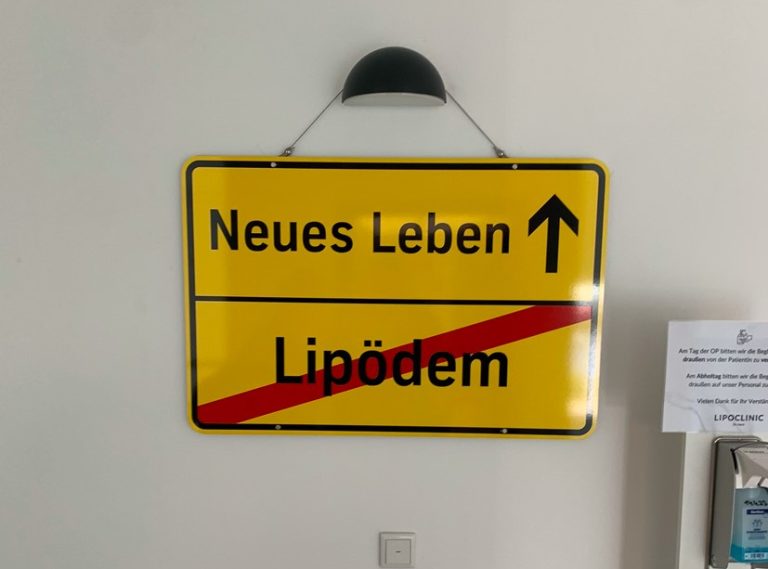 Lipödem: Durch die OPs habe ich ein neues Leben 27 Lipöpdem