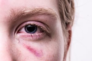 Vergewaltigung als Dreifachmama: Mein Weg zurück ins Leben